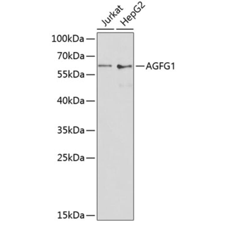 Western Blot - Anti-RAB Antibody (A90609) - Antibodies.com