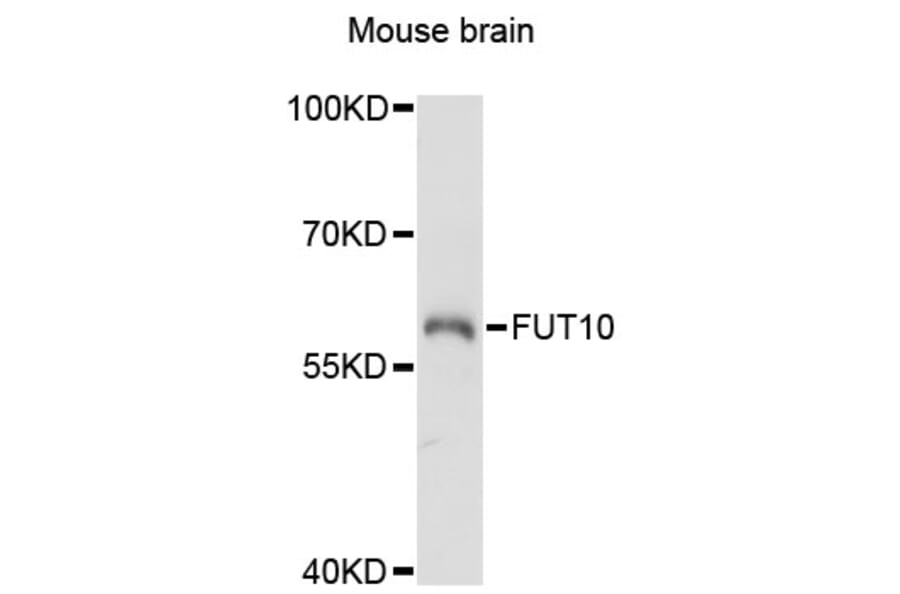 Western Blot - Anti-FUT10 Antibody (A13872) - Antibodies.com