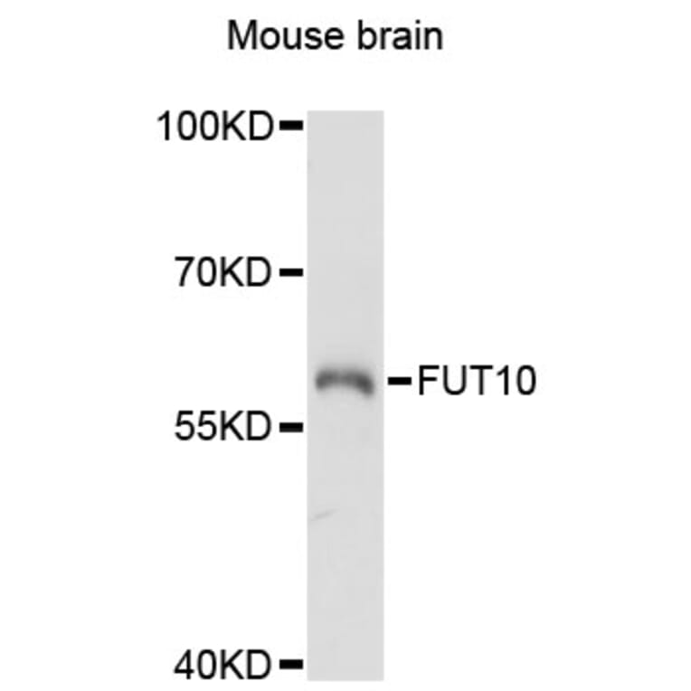 Western Blot - Anti-FUT10 Antibody (A13872) - Antibodies.com