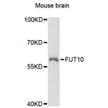 Western Blot - Anti-FUT10 Antibody (A13872) - Antibodies.com