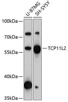 Western blot analysis of extracts of various cell lines, using Anti-TCP11L2 Antibody (A13239) at 1:3000 dilution.
Secondary antibody: Goat Anti-Rabbit IgG (H+L) (HRP) (AS014) at 1:10,000 dilution.
Lysates / proteins: 25µg per lane.
Blocking buffer: 3% non-fat dry milk in TBST.
Detection: ECL Basic Kit (RM00020).
Exposure time: 90s.