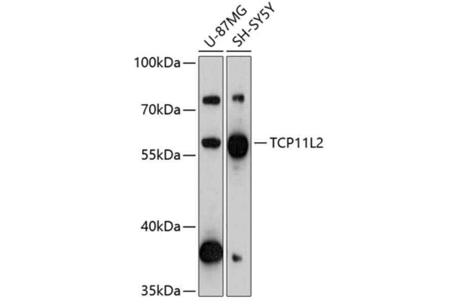Western Blot - Anti-TCP11L2 Antibody (A90611) - Antibodies.com