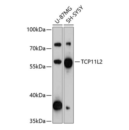 Western Blot - Anti-TCP11L2 Antibody (A90611) - Antibodies.com