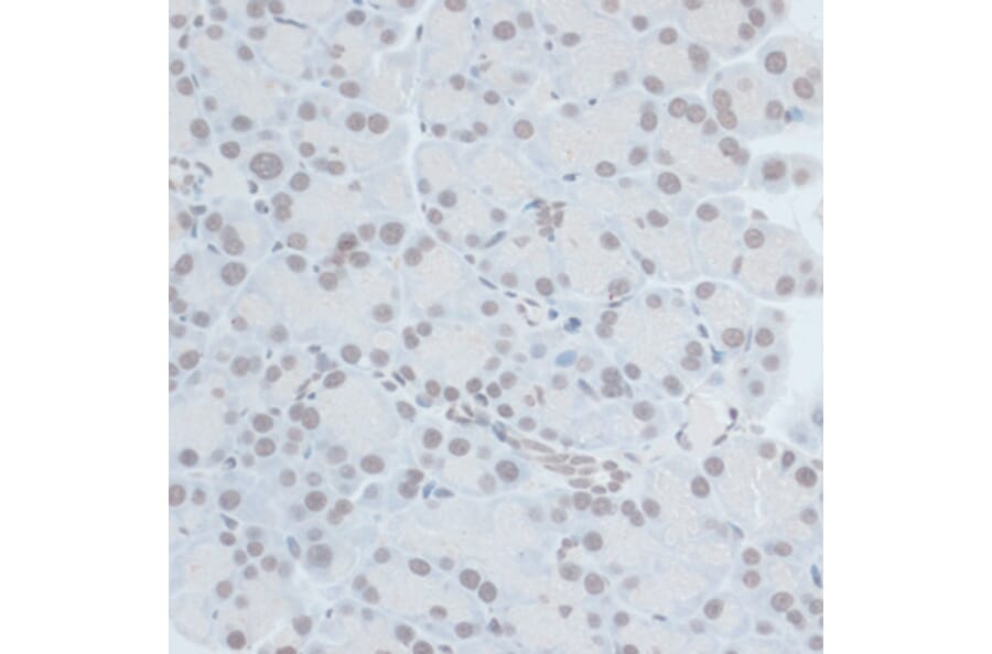 Immunohistochemistry - Anti-ZNF703 Antibody (A90612) - Antibodies.com