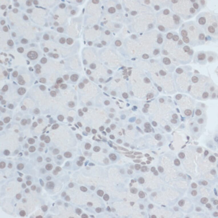 Immunohistochemistry - Anti-ZNF703 Antibody (A90612) - Antibodies.com