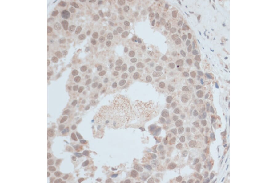 Immunohistochemistry - Anti-ZNF703 Antibody (A90612) - Antibodies.com