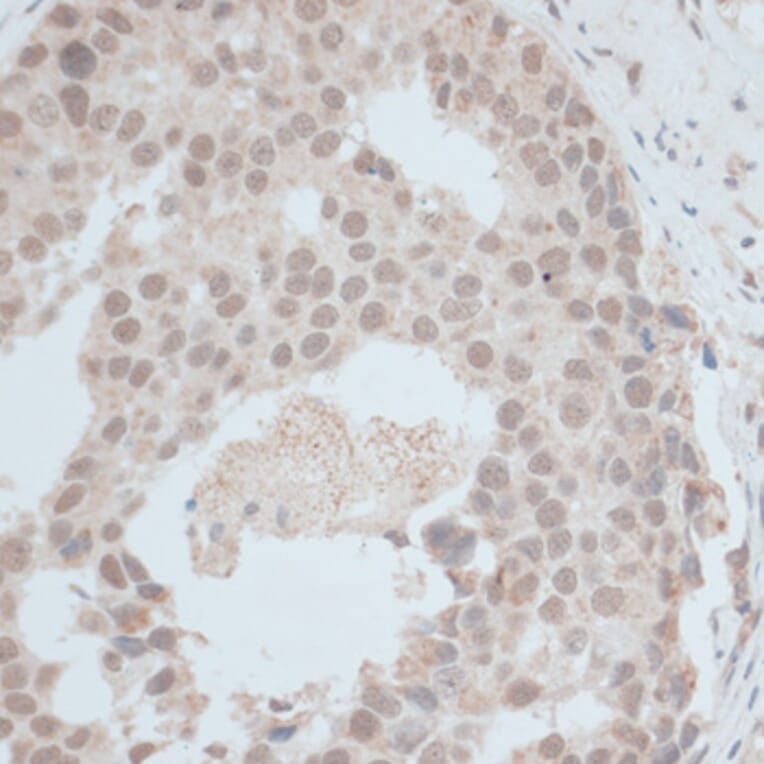 Immunohistochemistry - Anti-ZNF703 Antibody (A90612) - Antibodies.com