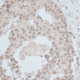 Immunohistochemistry - Anti-ZNF703 Antibody (A90612) - Antibodies.com