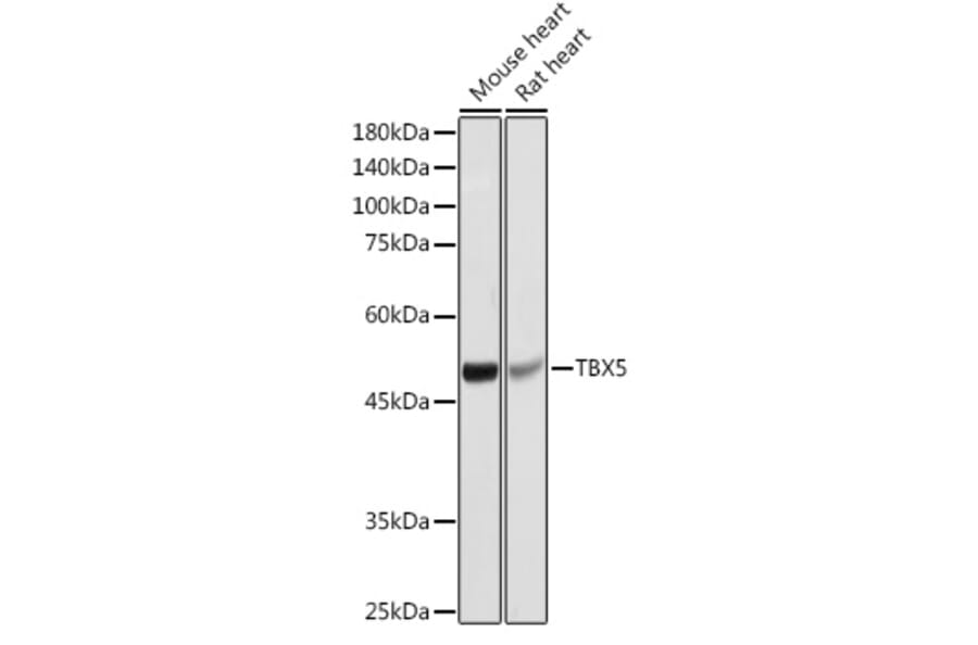 Western Blot - Anti-TBX5 Antibody (A90613) - Antibodies.com