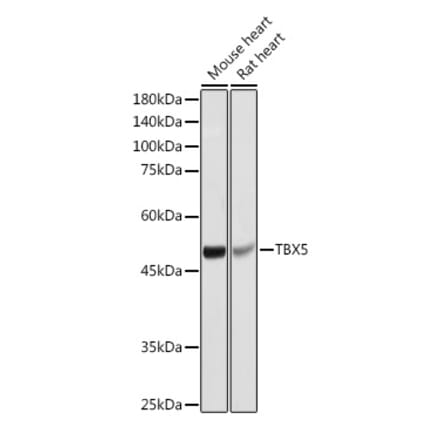Western Blot - Anti-TBX5 Antibody (A90613) - Antibodies.com