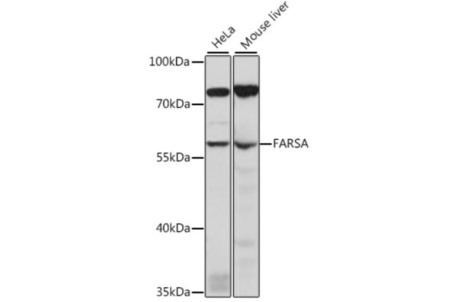 Western Blot - Anti-FARSLA Antibody (A90614) - Antibodies.com