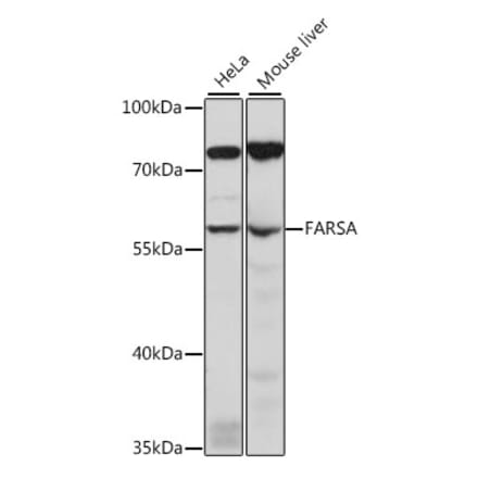 Western Blot - Anti-FARSLA Antibody (A90614) - Antibodies.com