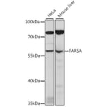 Western Blot - Anti-FARSLA Antibody (A90614) - Antibodies.com