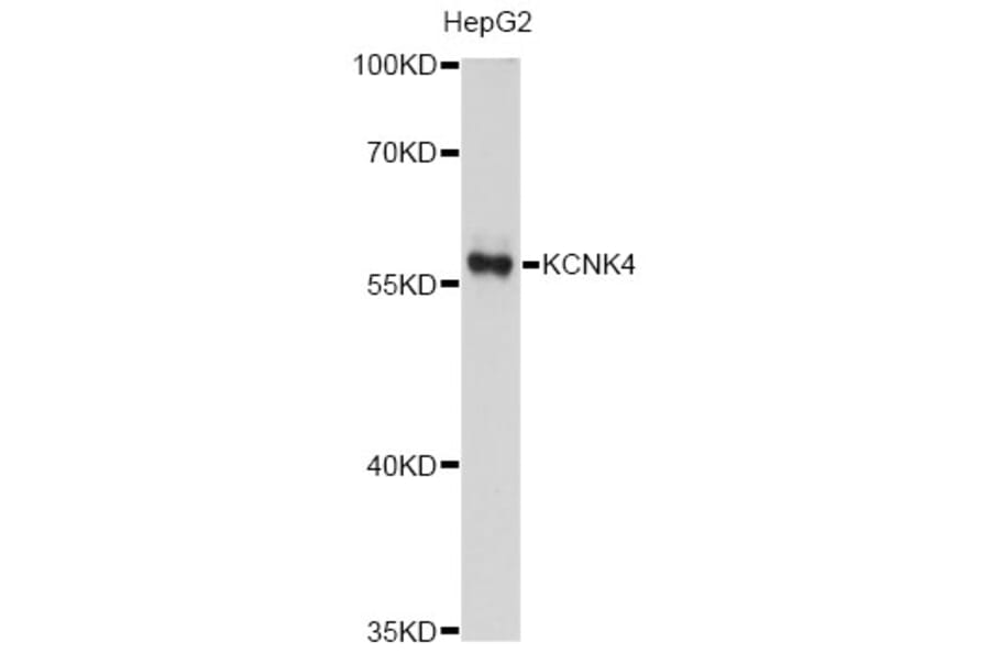 Western Blot - Anti-KCNK4 Antibody (A12217) - Antibodies.com