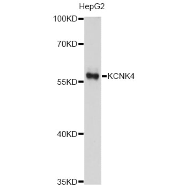Western Blot - Anti-KCNK4 Antibody (A12217) - Antibodies.com