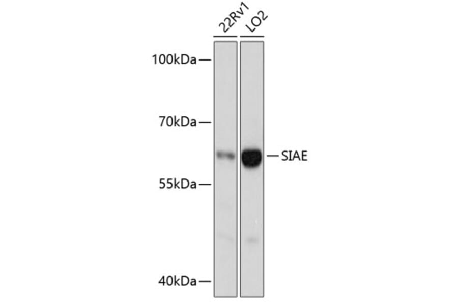 Western Blot - Anti-SIAE Antibody (A90616) - Antibodies.com