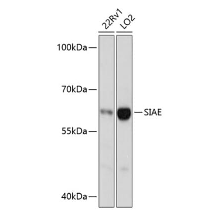 Western Blot - Anti-SIAE Antibody (A90616) - Antibodies.com