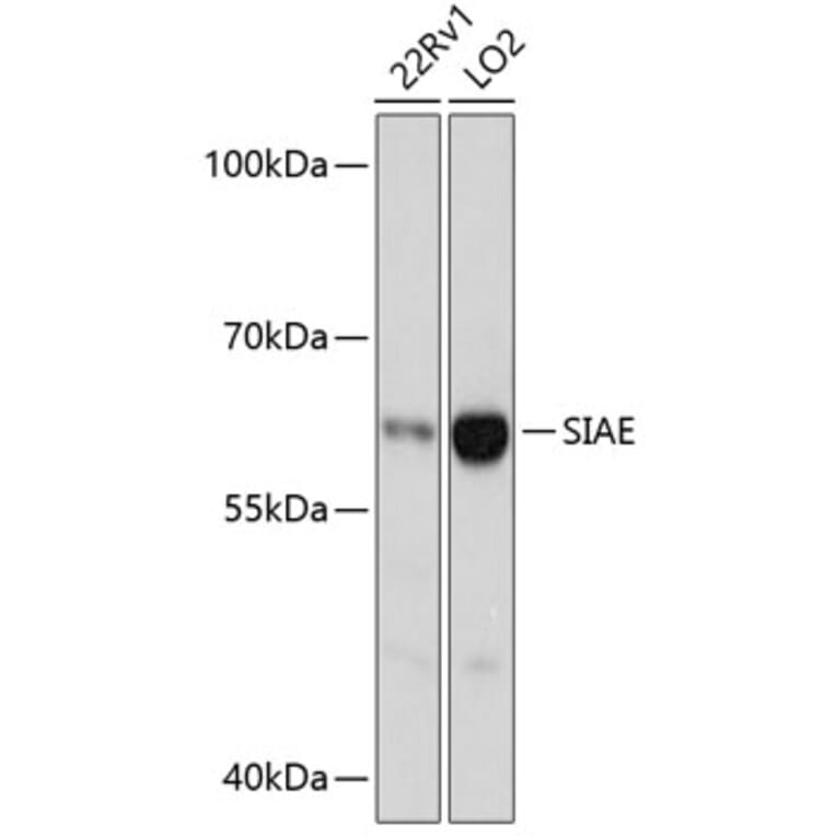 Western Blot - Anti-SIAE Antibody (A90616) - Antibodies.com