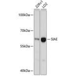 Western Blot - Anti-SIAE Antibody (A90616) - Antibodies.com