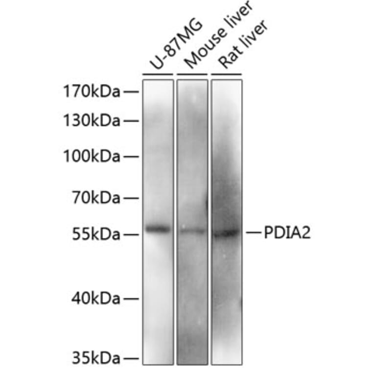 Western Blot - Anti-PDIA2/PDIP Antibody (A90617) - Antibodies.com