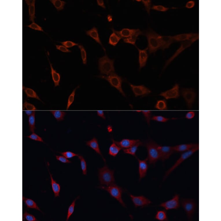 Immunofluorescence - Anti-PDIA2/PDIP Antibody (A90617) - Antibodies.com