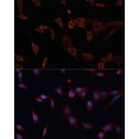 Immunofluorescence - Anti-PDIA2/PDIP Antibody (A90617) - Antibodies.com