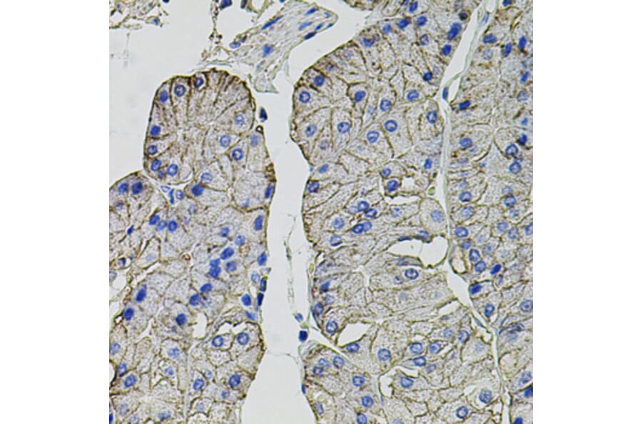Immunohistochemistry - Anti-Carbonic Anhydrase 9/CA9 Antibody (A90618) - Antibodies.com
