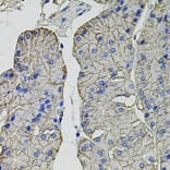 Immunohistochemistry - Anti-Carbonic Anhydrase 9/CA9 Antibody (A90618) - Antibodies.com