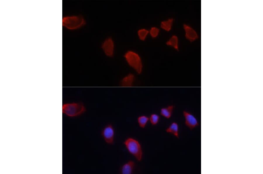 Immunofluorescence - Anti-Carbonic Anhydrase 9/CA9 Antibody (A90618) - Antibodies.com