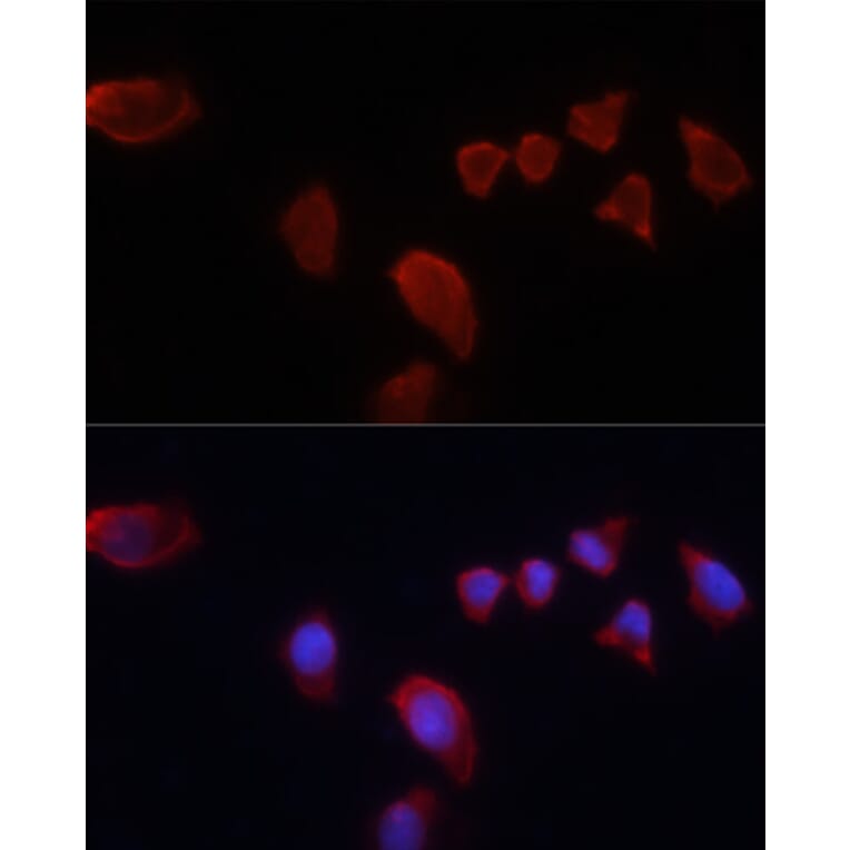 Immunofluorescence - Anti-Carbonic Anhydrase 9/CA9 Antibody (A90618) - Antibodies.com