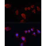 Immunofluorescence - Anti-Carbonic Anhydrase 9/CA9 Antibody (A90618) - Antibodies.com