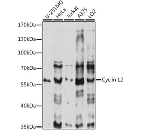 Western Blot - Anti-CCNL2 Antibody (A90619) - Antibodies.com