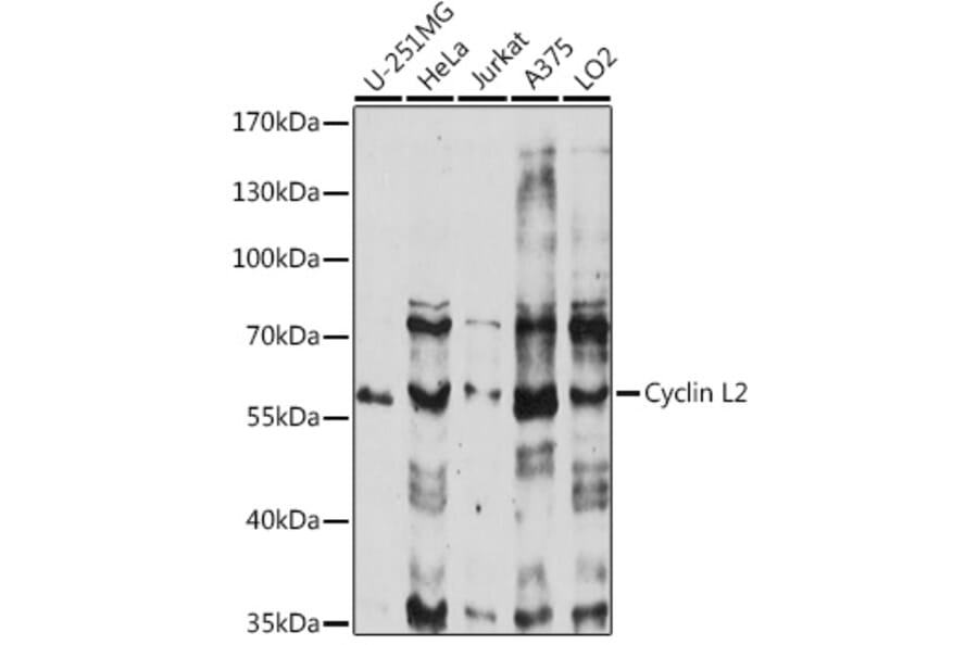 Western Blot - Anti-CCNL2 Antibody (A90619) - Antibodies.com