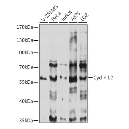 Western Blot - Anti-CCNL2 Antibody (A90619) - Antibodies.com