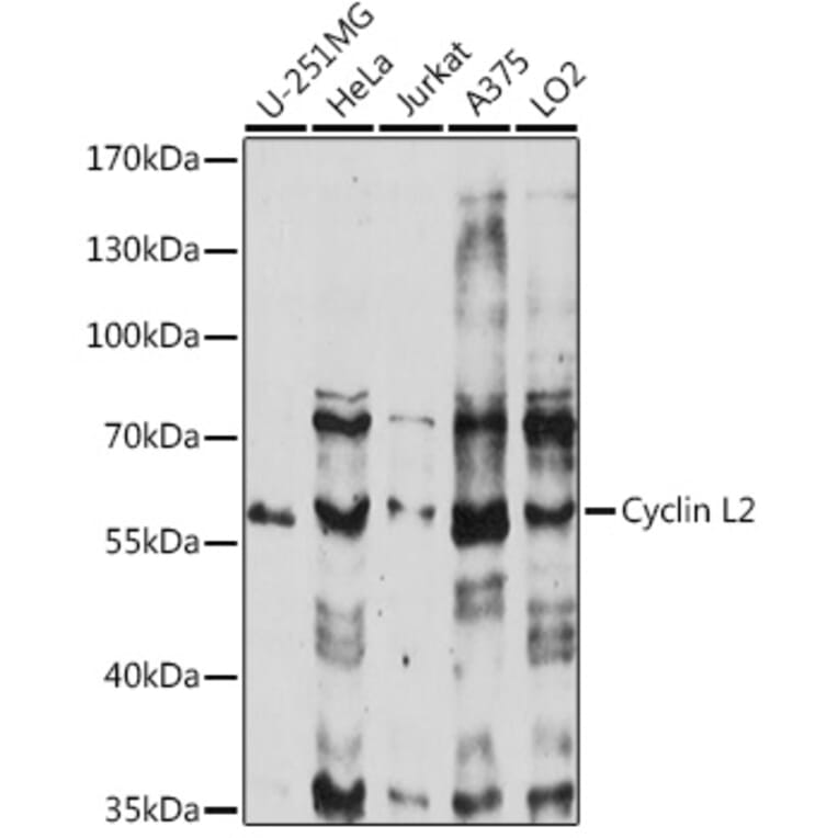 Western Blot - Anti-CCNL2 Antibody (A90619) - Antibodies.com
