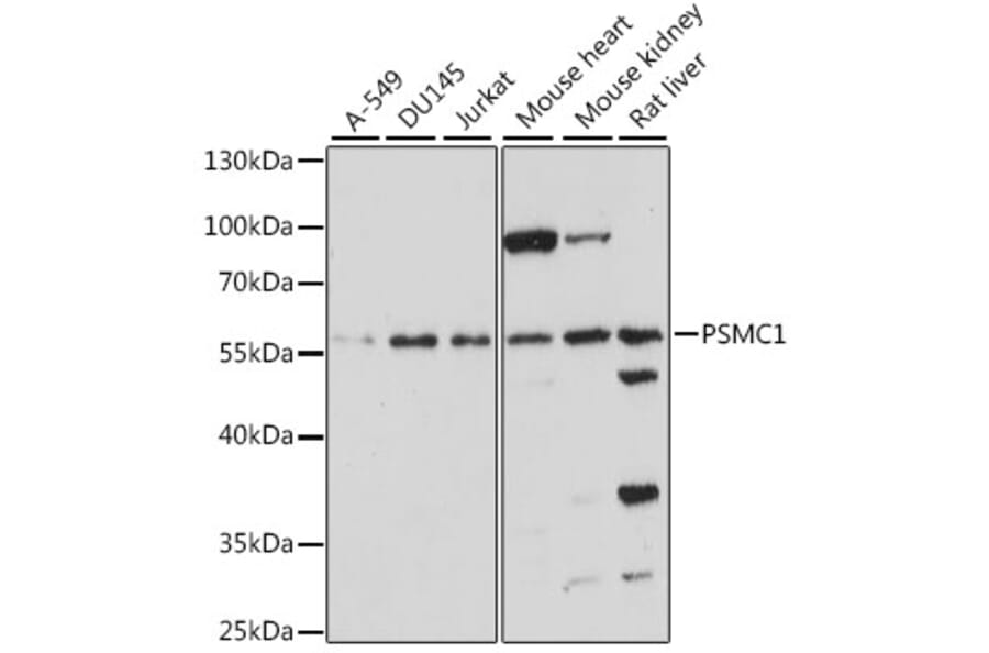 Western Blot - Anti-Proteasome 19S S4/PSMC1 Antibody (A90621) - Antibodies.com