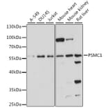 Western Blot - Anti-Proteasome 19S S4/PSMC1 Antibody (A90621) - Antibodies.com