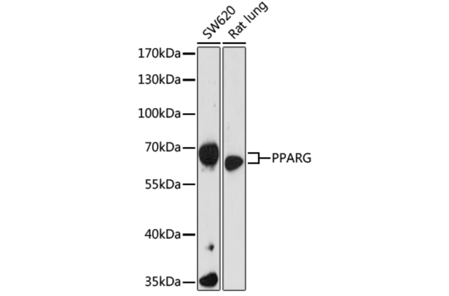 Western Blot - Anti-PPARG Antibody (A16958) - Antibodies.com