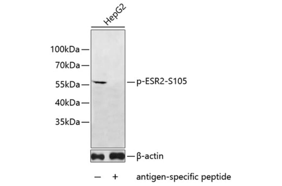 Western Blot - Anti-ESR2 (phospho S105) Antibody (AP0648) - Antibodies.com