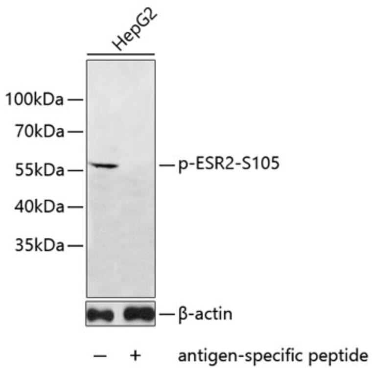 Western Blot - Anti-ESR2 (phospho S105) Antibody (AP0648) - Antibodies.com