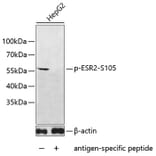 Western Blot - Anti-ESR2 (phospho S105) Antibody (AP0648) - Antibodies.com