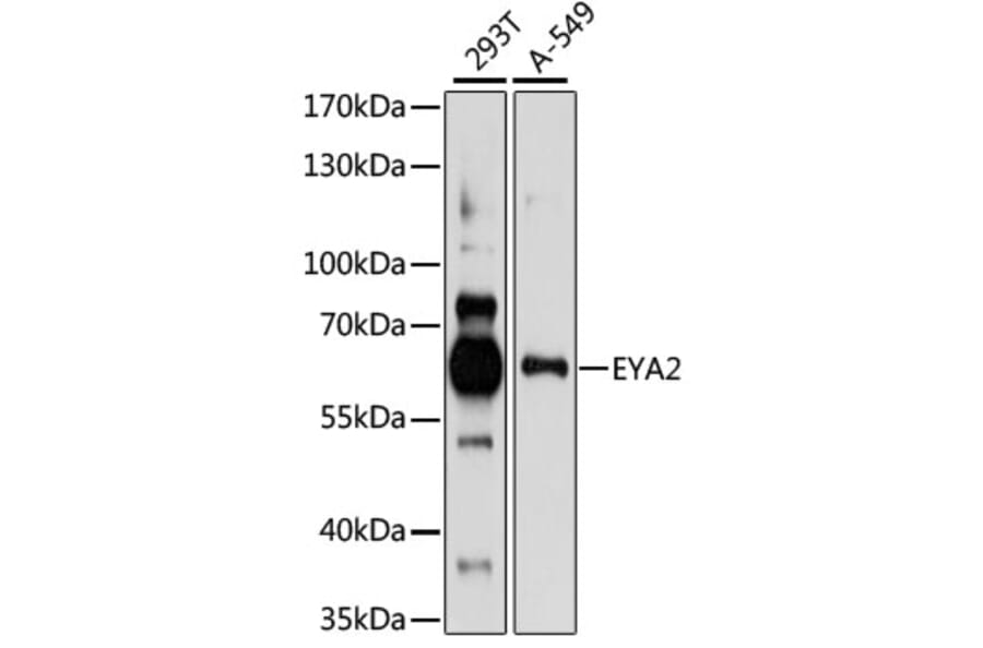 Western Blot - Anti-EYA2 Antibody (A90624) - Antibodies.com