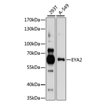 Western Blot - Anti-EYA2 Antibody (A90624) - Antibodies.com