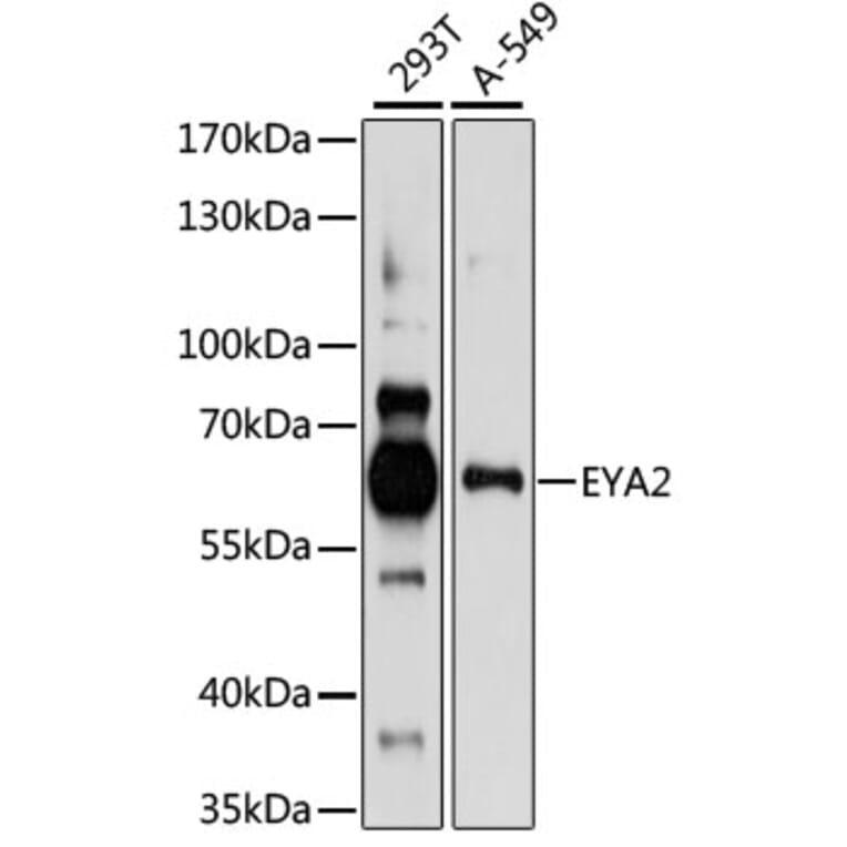 Western Blot - Anti-EYA2 Antibody (A90624) - Antibodies.com