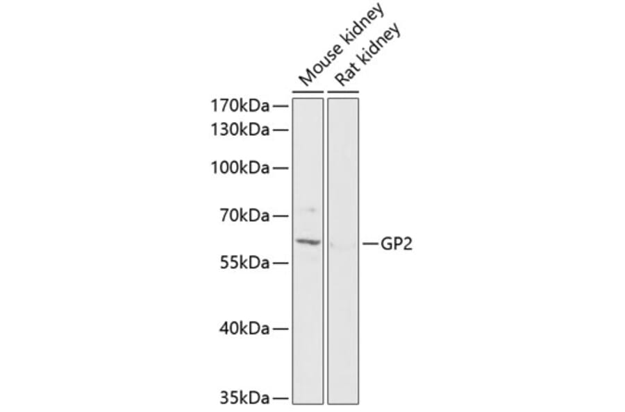 Anti Gp2 Antibody A90625