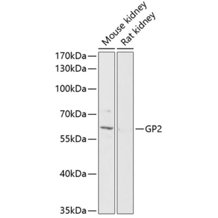 Western Blot - Anti-GP2 Antibody (A90625) - Antibodies.com