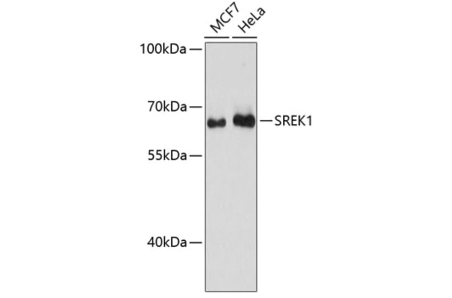 Western Blot - Anti-SREK1 Antibody (A90626) - Antibodies.com