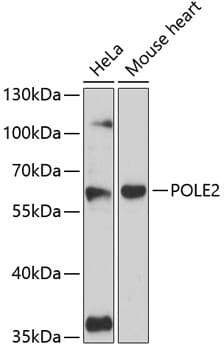 Western blot analysis of extracts of various cell lines, using Anti-POLE2 Antibody (A12842) at 1:3000 dilution.
Secondary antibody: Goat Anti-Rabbit IgG (H+L) (HRP) (AS014) at 1:10,000 dilution.
Lysates / proteins: 25µg per lane.
Blocking buffer: 3% non-fat dry milk in TBST.
Detection: ECL Basic Kit (RM00020).
Exposure time: 90s.