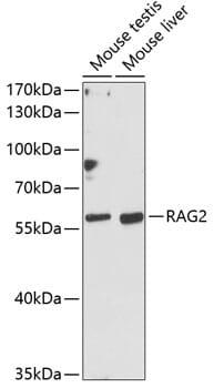 Western blot analysis of extracts of various cell lines, using Anti-RAG2 Antibody (A12488) at 1:1,000 dilution.
Secondary antibody: Goat Anti-Rabbit IgG (H+L) (HRP) (AS014) at 1:10,000 dilution.
Lysates / proteins: 25µg per lane.
Blocking buffer: 3% non-fat dry milk in TBST.
Detection: ECL Basic Kit (RM00020).
Exposure time: 90s.