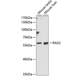 Western Blot - Anti-RAG2 Antibody (A90629) - Antibodies.com